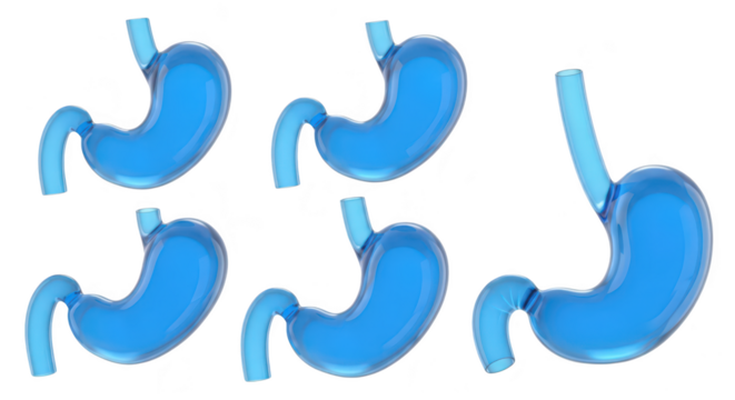 Rendered illustration of five human stomachs in different orientations isolated on white ideal for medical or educational purposes - Powered by Adobe
