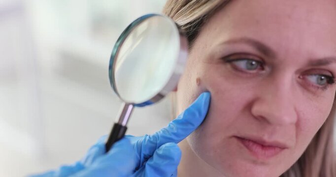 Doctor in gloves holds magnifying glass to woman cheek focusing on mole. Dermatological examination of skin health and detection of skin conditions