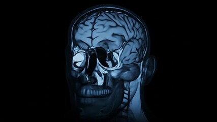 Detailed MRI scan of human brain in side profile showing neural structures and cerebrospinal fluid flow