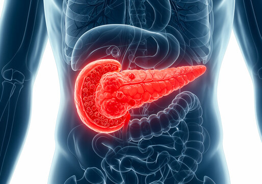 3D Medical Visualization of Pancreatic Tumors