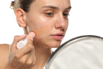 Young woman applying concealer on acne-prone skin, studio shot on white background