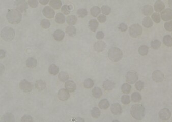 blood serum under microscope. full frame