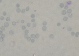 blood serum under microscope. full frame
