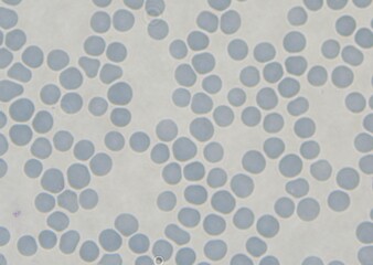 blood serum under microscope. full frame