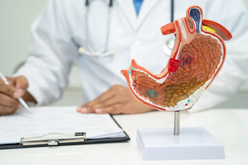 Stomach disease, doctor holding anatomy model for study diagnosis and treatment in hospital.
