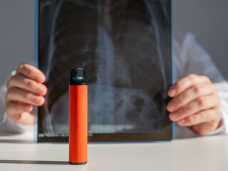 Doctor holding x-ray of lungs with vape in background. 