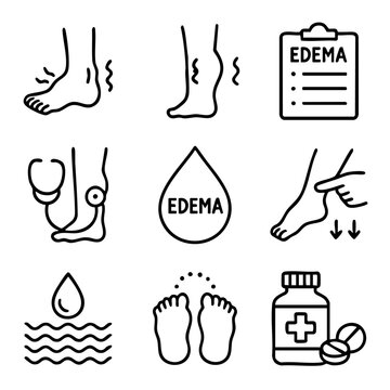 A set of doodle line icons illustrating edema symptoms, swelling in feet, fluid retention, diagnosis, and medical treatment solutions