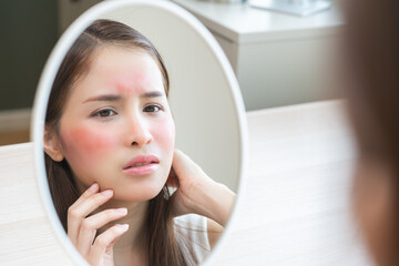 Dermatology, scratch asian young woman looking at mirror, expression worry and itch, itchy allergy or allergic sensitive reaction, red spot or rash on her face. Beauty care from skin problem treatment