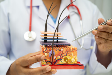 Hair transplant, Asian dermatologist doctor holding skin structure anatomy model for treatment in hospital.