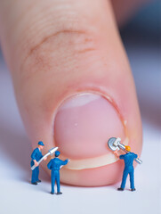 Tiny workers repairing a human fingernail