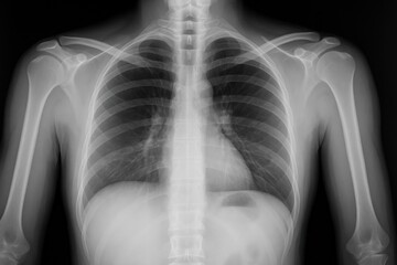 Detailed chest X-ray image.