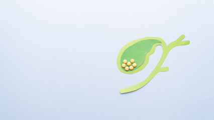 Gallbladder with gallstones (cholelithiasis) anatomy made from paper on blue background. Gallstone blocks the flow of bile through your biliary system causing cholecystitis, pancreatitis, cholangitis.