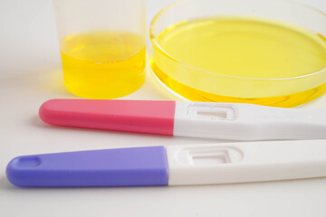 Urinalysis, pregnancy test and urine cup for female of ovulation day, fetus, maternity, childbirth, birth control.