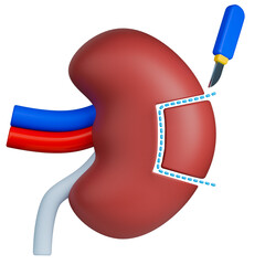 Nephrectomy surgery 3d illustration, showing kidney incision with scalpel and highlighted cut path.