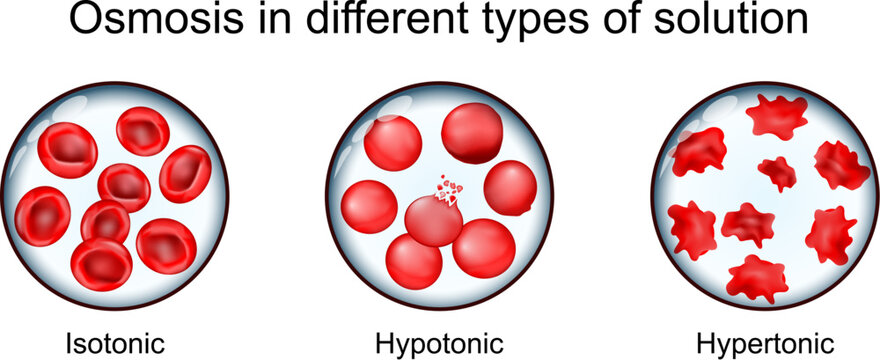 Red blood cell in Hypertonic, Hypotonic and Isotonic solution.