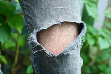 hole on knee with edges with skin of leg in men's gray fashion stylish worn with stripe jeans near green leaves in daytime outdoors