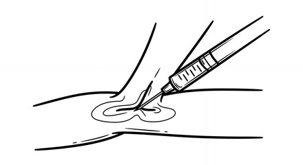 Cyst Aspiration Line Art Depicting Syringe Needle Extracting Fluid medical hand drawn sketch line art outline doodle minimal minimalistic black white simple cartoon drawing illustration monochrome
