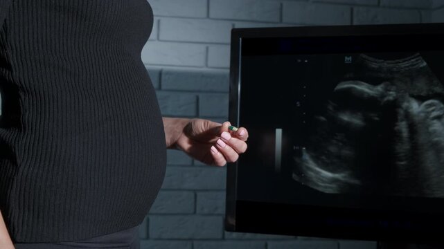 Lady with problem pregnancy with pill. A woman with pregnancy problems drink a pill with water in her hands