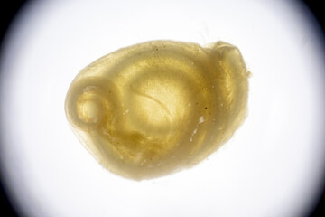 The nematodes (Nematoda), roundworms or eelworms constitute the phylum Nematoda. Species in the phylum inhabit a broad range of environments. Found in freshwater crabs.