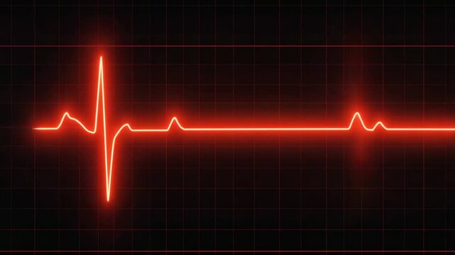 A glowing red electrocardiogram line showing a normal sinus rhythm on a dark grid, symbolizing health and life.