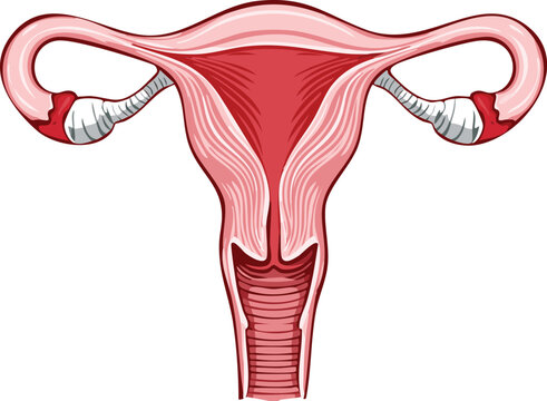 Anatomical illustration of the female reproductive system, showing the uterus, fallopian tubes, and ovaries.