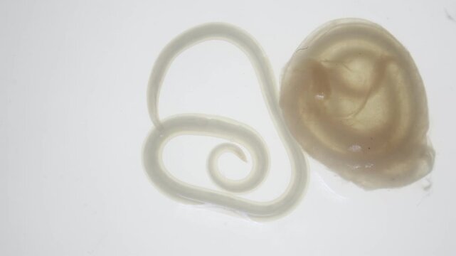 The nematodes (Nematoda), roundworms or eelworms constitute the phylum Nematoda. Species in the phylum inhabit a broad range of environments. Found in freshwater crabs.