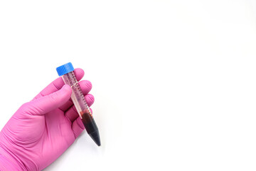 Blood. Hand with a pink glove and a test tube. Space for text.