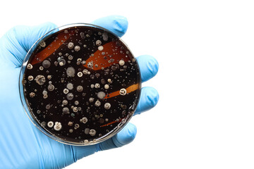 Microbiology. Hand with a blue glove and a bacterial culture plate.