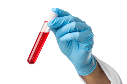 Medical Hand Holding Blood Sample Laboratory Analysis and Healthcare Concept