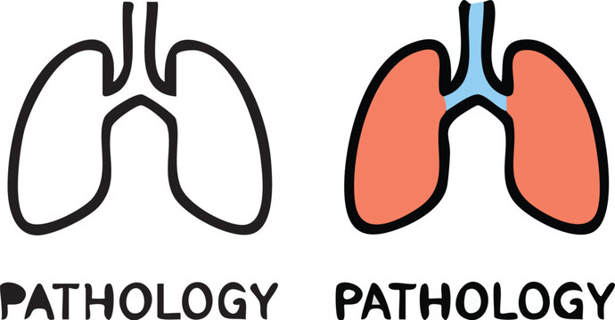 Lungs Pathology Comparison Illustration.
