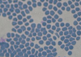 blood serum under microscope. full frame	
