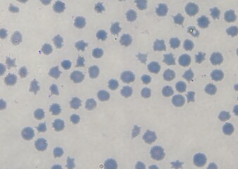 blood serum under microscope. full frame	
