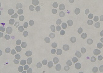 blood serum under microscope. full frame	
