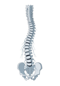Scoliosis Spine Illustration Curved Vertebral Column with Pelvis and Nerves.