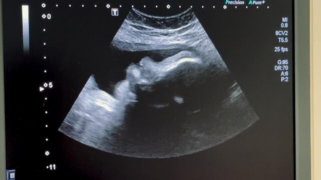 2D Ultrasound display of 30 weeks pregnant. Fetus ultrasound image that show important organs.	
