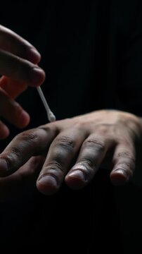 A person applies a medicinal ointment with a cotton swab to cut and injured skin.
Skin treatment and application of a medicinal preparation with a cotton swab.
Medical ointment close-up
