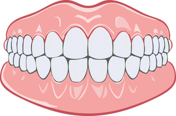 Illustration showing a full set of dentures, with white teeth set in pink gums, viewed frontally.