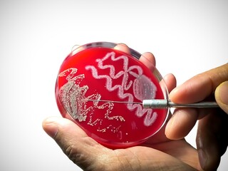 Microbiologist checking bacterial colony for the identification of organism.