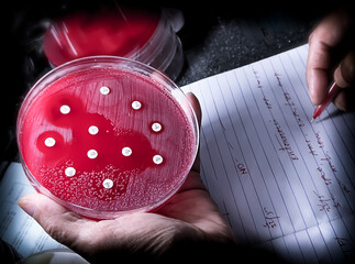 Microbiologist checking and noted antibiotic resistance of bacteria in blood agar medium, Antibiotic susceptibility testing.
