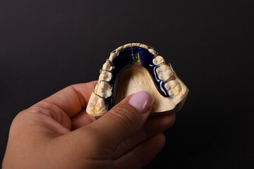 Medical equipment, orthodontic retainer.