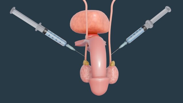 A 3d rendering of male reproductive system and a medical syringe. A concept or procedure related to male contraception, a form of injectable birth control that targets the testes. 