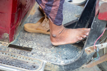 A young man put his foot on the car brake.