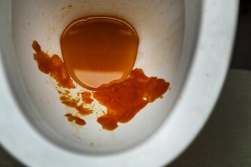 Red-orange paste-like substance in white toilet bowl, unflushed, showing potential plumbing issue or unusual waste deposit