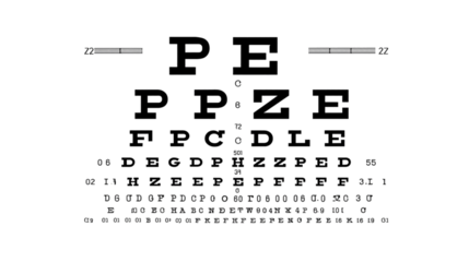 A very dark and grainy image featuring multiple light spots and horizontal lines in the darkness