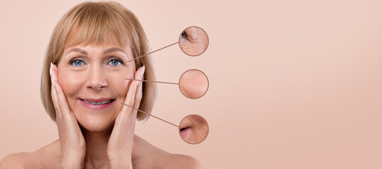 Beauty and skincare concept. Collage of attractive senior woman with zoomed zones showing skin...