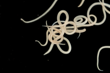 The nematodes (Nematoda), roundworms or eelworms constitute the phylum Nematoda. Species in the phylum inhabit a broad range of environments. Found in freshwater crabs.