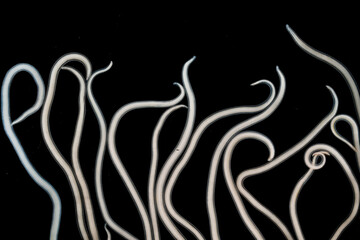 The nematodes (Nematoda), roundworms or eelworms constitute the phylum Nematoda. Species in the phylum inhabit a broad range of environments. Found in freshwater crabs.
