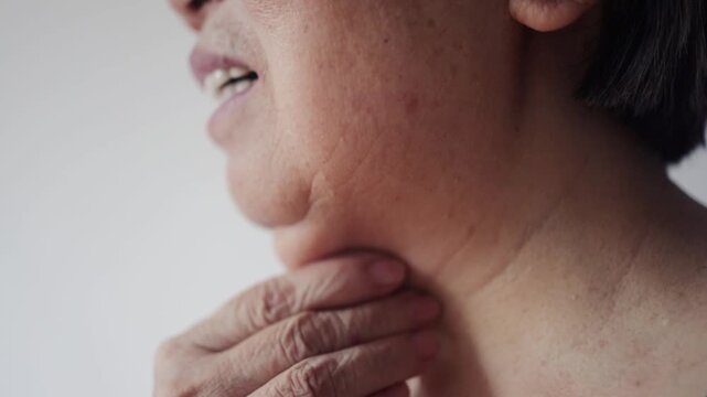 Double chin face mature woman 50 years old, human fat neck, side view, wrinkles on skin, facelift, age-related skin changes, aesthetic injection cosmetology, care anti-aging procedures