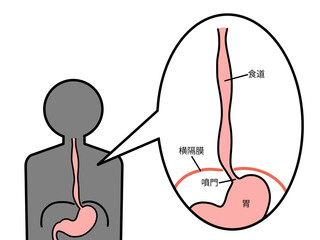 正常な食道　横隔膜　文字あり