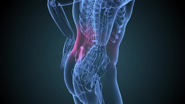 Disc Herniation Images – Browse 14,162 Stock Photos, Vectors, and Video ...